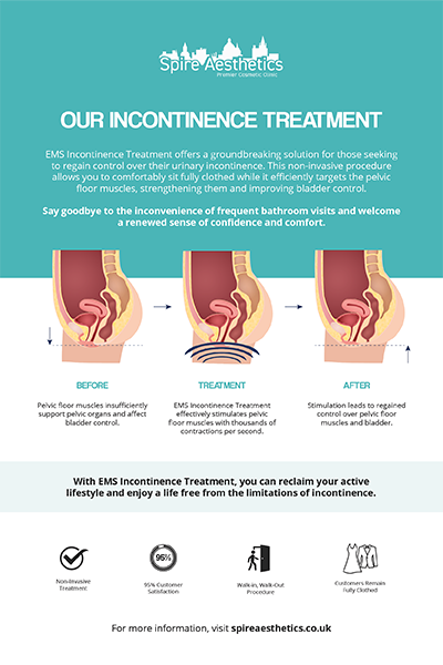 image of how urge incontinence Dunchurch treatment works