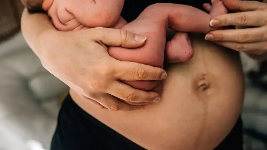 Why Is My Stomach Still Big After Pregnancy Dunchurch?