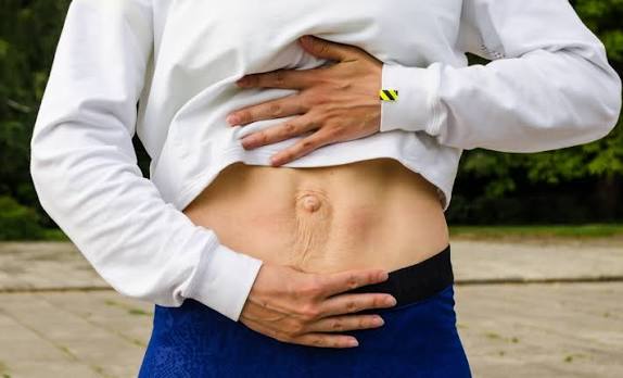 When Could Diastasis Recti Be the Missing Piece of the Puzzle Dunchurch?